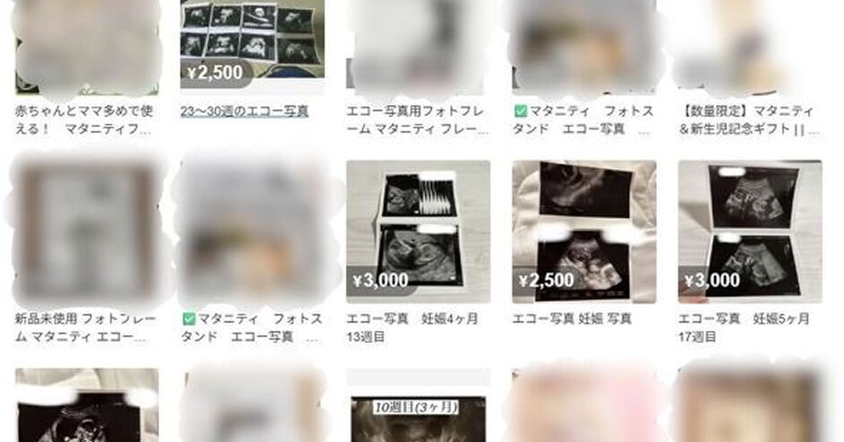ひろゆきも憤り!メルカリで胎児エコー写真出品禁止!詐欺に問われる可能性も!