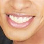 草間リチャード敬太の「歯」が話題！歯並び・セラミック治療の噂と真相を徹底解説