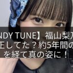 【CANDY TUNE】福山梨乃は歯列矯正してた？約5年間の治療を経て真の姿に！