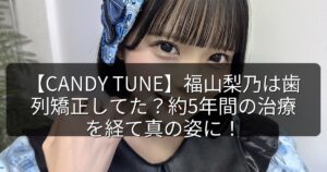 【CANDY TUNE】福山梨乃は歯列矯正してた?約5年間の治療を経て真の姿に!